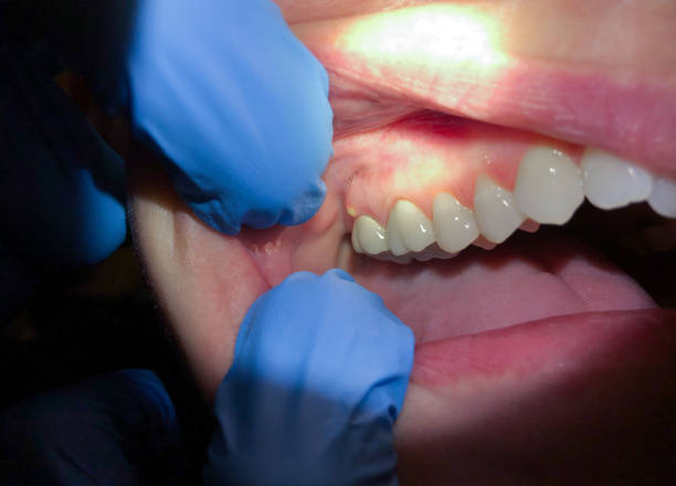 Best Tooth Pain Emergency Relief  in Cleburne, TX