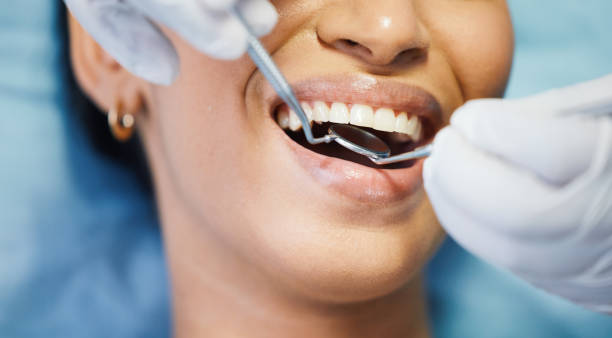 Best Chipped Tooth Repair Near Me  in Cleburne, TX