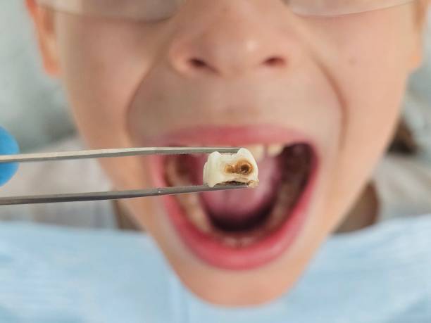 Best Emergency Gum Pain Relief  in Cleburne, TX